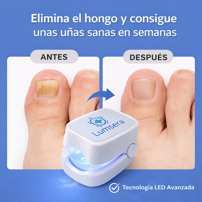 Lumsera OnyClean Pro™